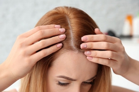 Hair Loss Treatment FAQ