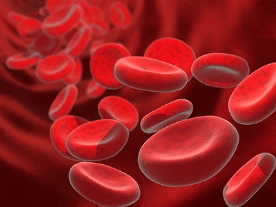 What Are the Causes, Symptoms and Treatment of Anemia?